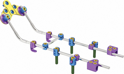 KCO3.2 &nbsp;Posterio Cervical System 730