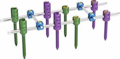 Spinal System（Double Core and Double Thread Type