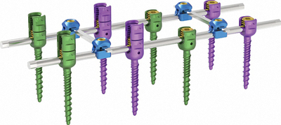 RSS-III Spinal System 748