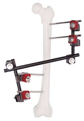 Universal pin rod coupling Z type