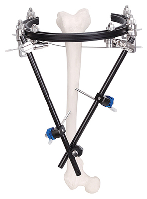 Carbon fiber composite ring Three-dimensional type