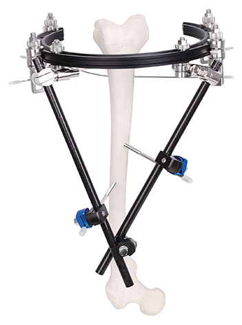 Carbon fiber composite ring Three-dimensional type