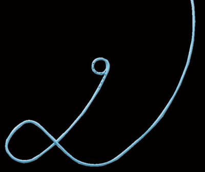 BILIARY DRAINAGE CATHETER